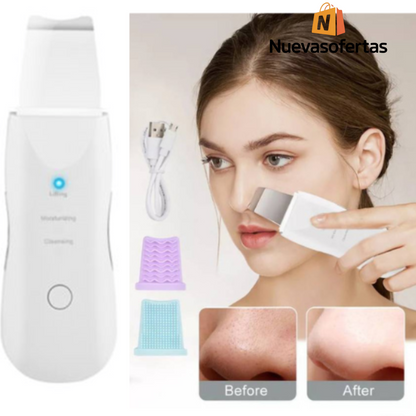 Limpiador Facial Espátula Ultrasónico